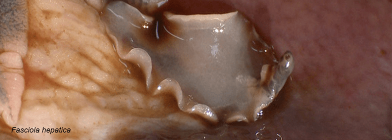 liver fluke